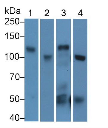 Polyclonal Antibody to Angiotensin I Converting Enzyme 2 (ACE2)