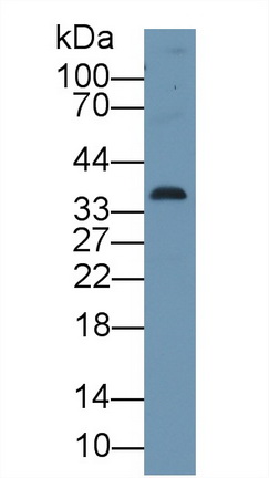 Polyclonal Antibody to Cyclin Dependent Kinase 1 (CDK1)