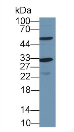 Polyclonal Antibody to Cyclin Dependent Kinase 1 (CDK1)