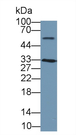 Polyclonal Antibody to Cyclin Dependent Kinase 1 (CDK1)