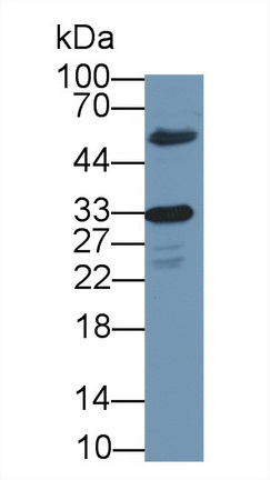 Polyclonal Antibody to Cyclin Dependent Kinase 1 (CDK1)