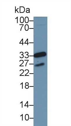 Polyclonal Antibody to Cyclin Dependent Kinase 1 (CDK1)