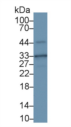 Polyclonal Antibody to Cyclin Dependent Kinase 1 (CDK1)