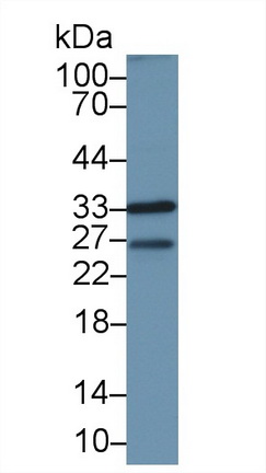 Polyclonal Antibody to Cyclin Dependent Kinase 1 (CDK1)