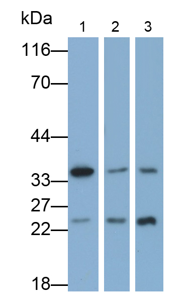 Polyclonal Antibody to Cyclin Dependent Kinase 1 (CDK1)