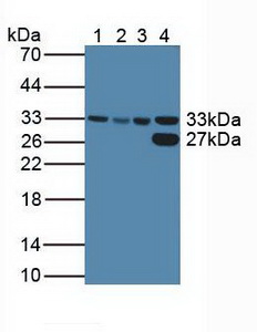 Polyclonal Antibody to Cyclin Dependent Kinase 2 (CDK2)