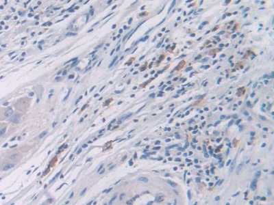 Polyclonal Antibody to Cyclin Dependent Kinase 2 (CDK2)