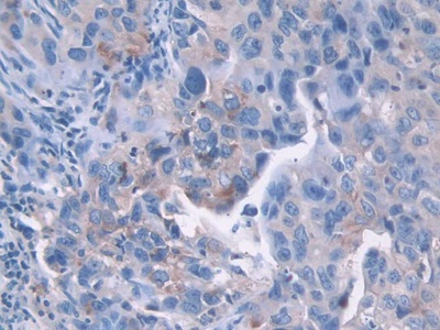 Polyclonal Antibody to Cyclin Dependent Kinase 2 (CDK2)