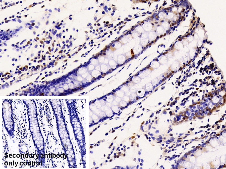 Polyclonal Antibody to Cyclin Dependent Kinase 2 (CDK2)