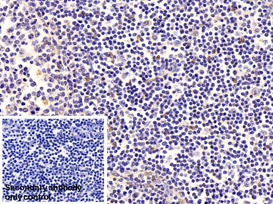 Polyclonal Antibody to Cyclin Dependent Kinase 2 (CDK2)