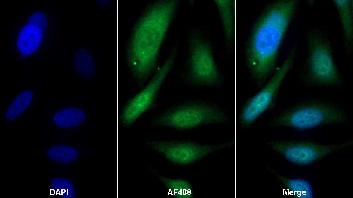 Polyclonal Antibody to Cyclin Dependent Kinase 2 (CDK2)