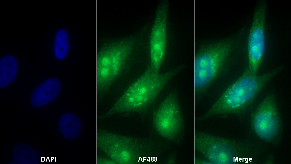 Polyclonal Antibody to Cyclin Dependent Kinase 2 (CDK2)