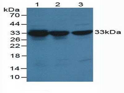 Polyclonal Antibody to Cyclin Dependent Kinase 2 (CDK2)