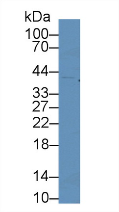 Polyclonal Antibody to Cyclin Dependent Kinase 2 (CDK2)