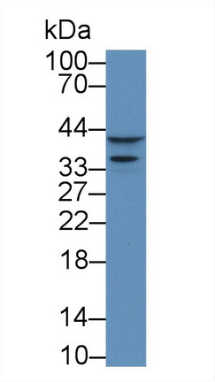 Polyclonal Antibody to Cyclin Dependent Kinase 2 (CDK2)