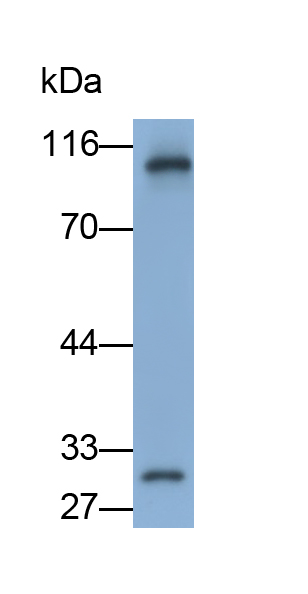 Polyclonal Antibody to Cyclin Dependent Kinase 2 (CDK2)