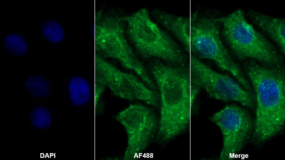 Polyclonal Antibody to Vascular Endothelial Growth Factor Receptor 3 (VEGFR3)