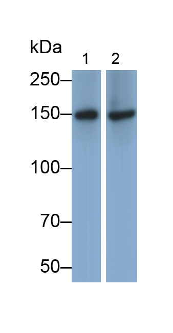 Polyclonal Antibody to Vascular Endothelial Growth Factor Receptor 3 (VEGFR3)