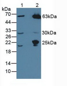 Polyclonal Antibody to Mannose Associated Serine Protease 1 (MASP1)