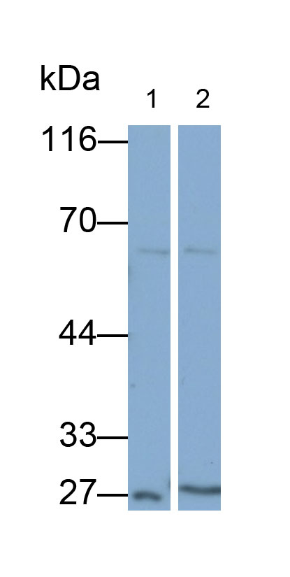 Polyclonal Antibody to Mannose Associated Serine Protease 1 (MASP1)