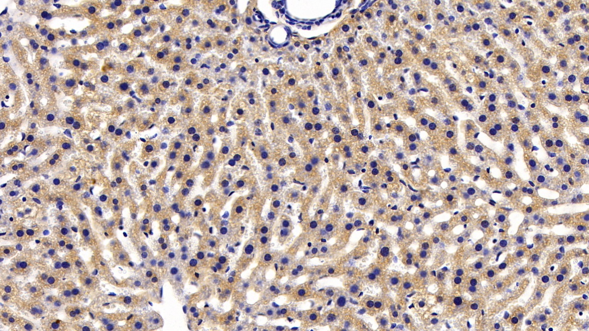 Polyclonal Antibody to Insulin Degrading Enzyme (IDE)