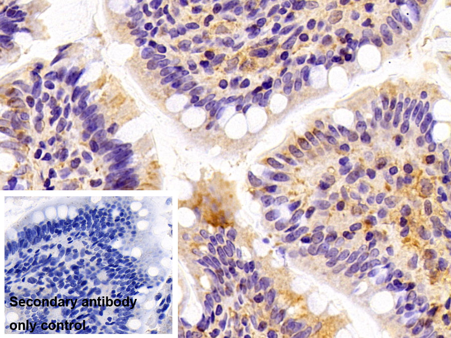 Polyclonal Antibody to Insulin Degrading Enzyme (IDE)