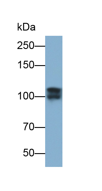 Polyclonal Antibody to Insulin Degrading Enzyme (IDE)