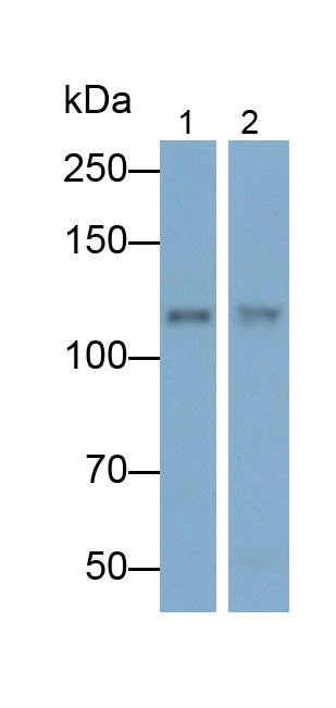 Polyclonal Antibody to Insulin Degrading Enzyme (IDE)