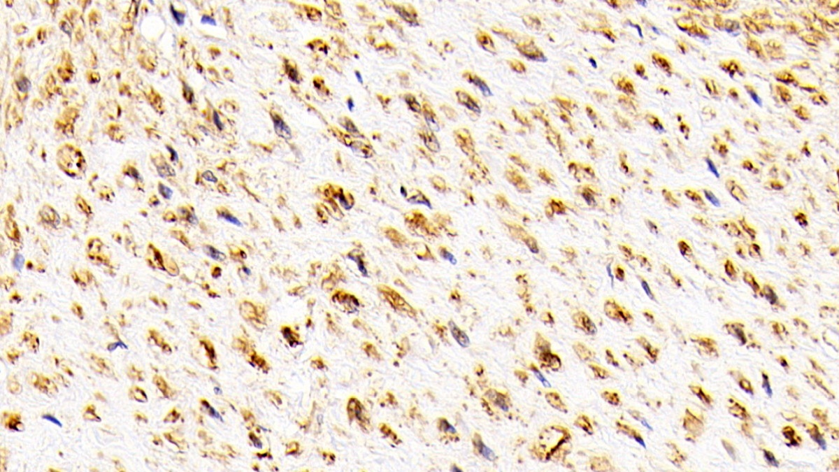 Polyclonal Antibody to Oxidosqualene Cyclase (OSC)