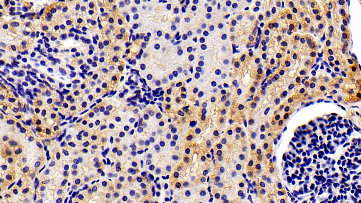 Polyclonal Antibody to Oxidosqualene Cyclase (OSC)