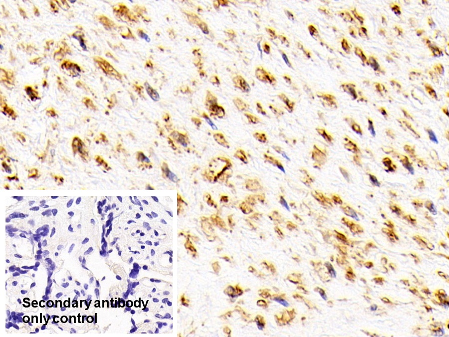 Polyclonal Antibody to Oxidosqualene Cyclase (OSC)