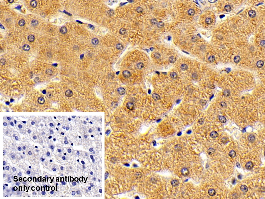 Polyclonal Antibody to Oxidosqualene Cyclase (OSC)