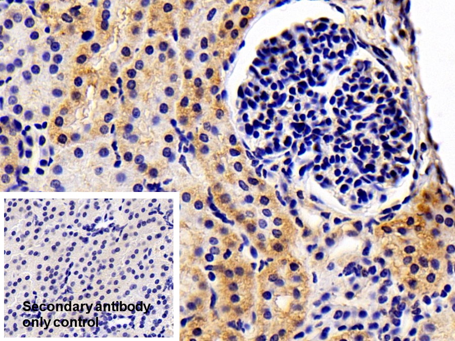 Polyclonal Antibody to Oxidosqualene Cyclase (OSC)