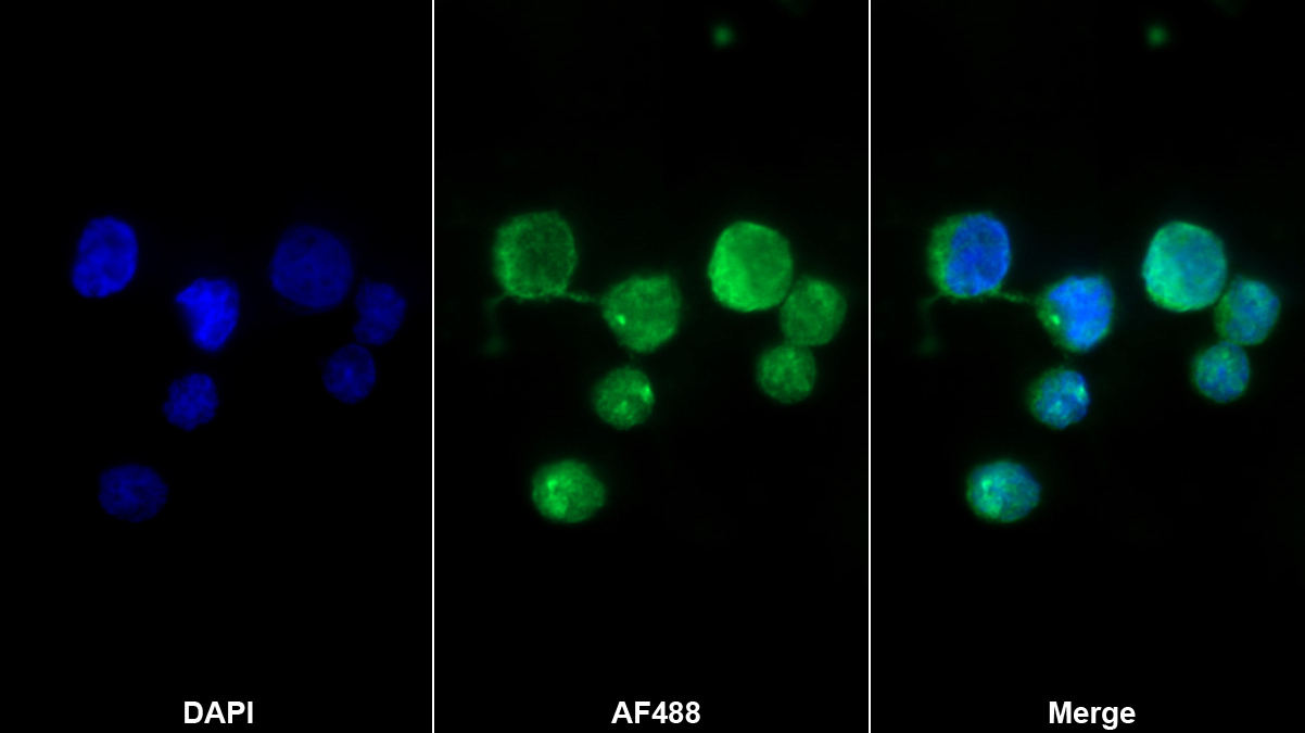 Polyclonal Antibody to Interferon Gamma Inducible Protein 16 (IFI16)