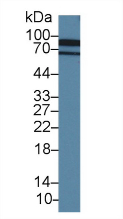 Polyclonal Antibody to Cadherin, Heart (CDHH)