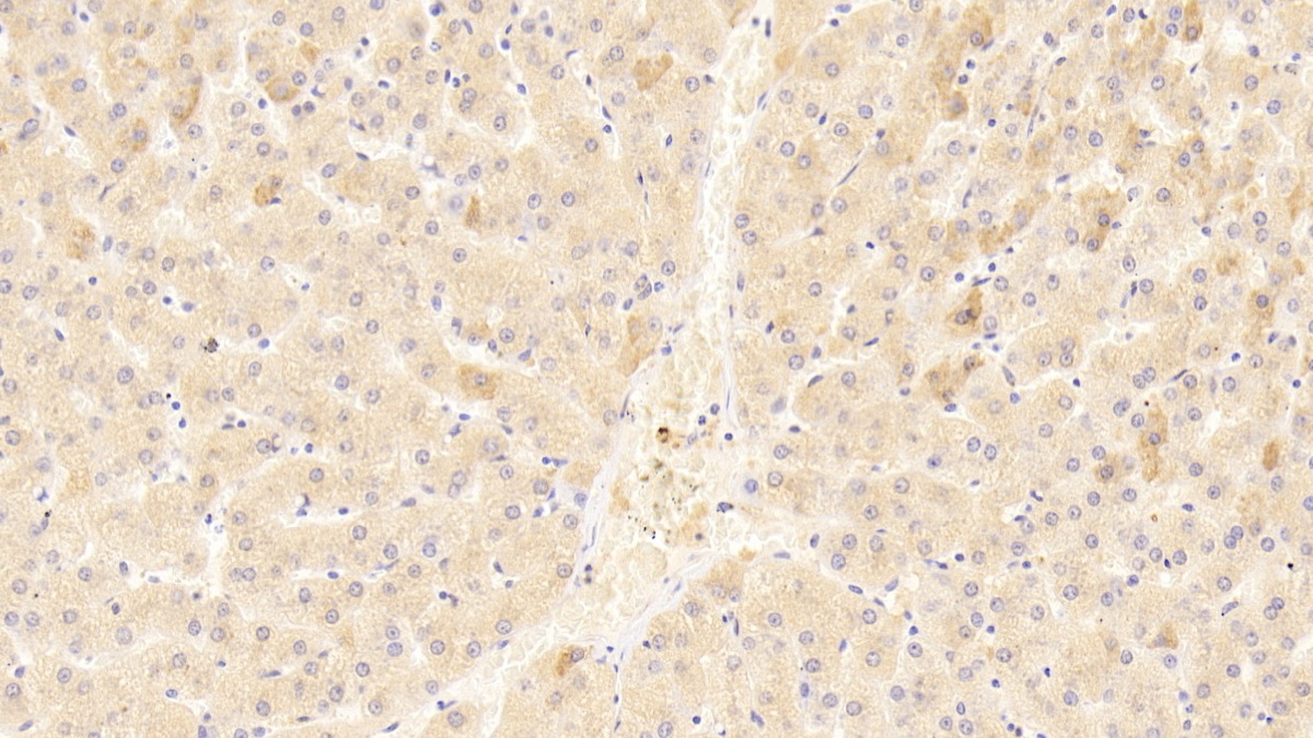 Polyclonal Antibody to Cadherin, Heart (CDHH)