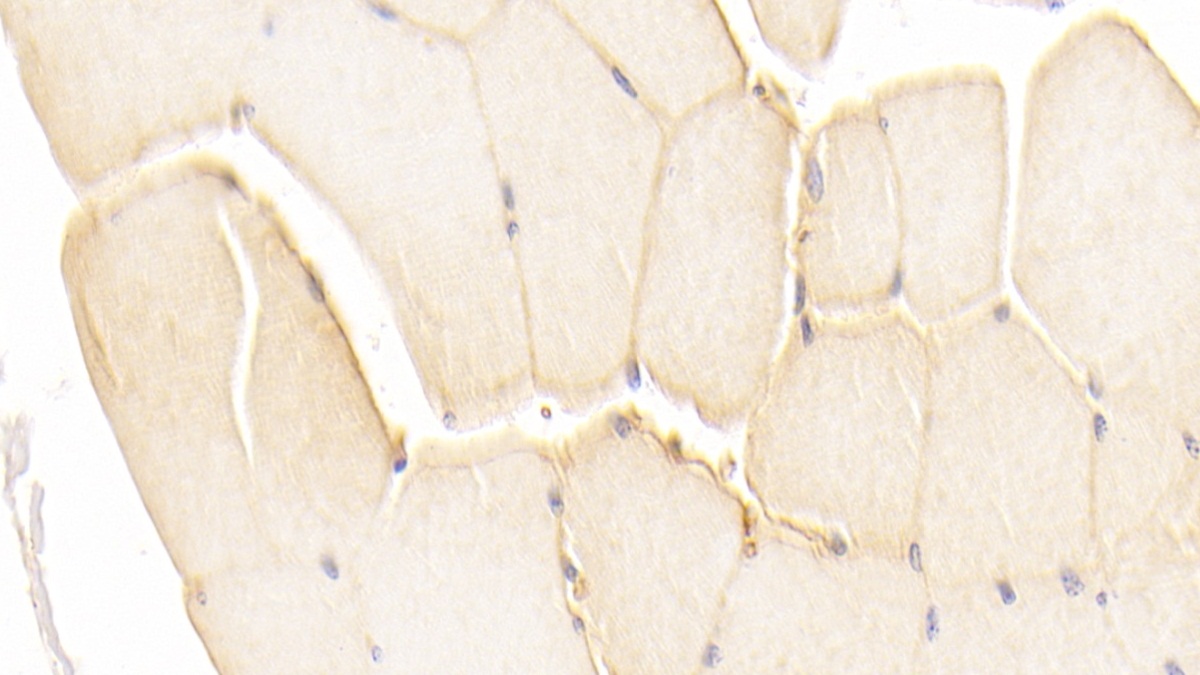 Polyclonal Antibody to Cadherin, Heart (CDHH)