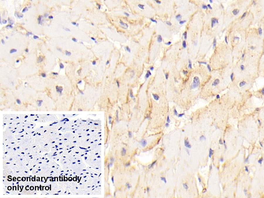 Polyclonal Antibody to Cadherin, Heart (CDHH)