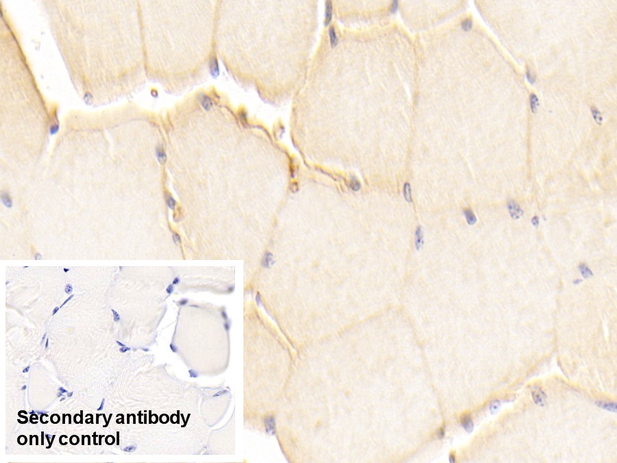 Polyclonal Antibody to Cadherin, Heart (CDHH)