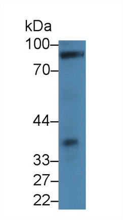 Polyclonal Antibody to Cadherin, Heart (CDHH)