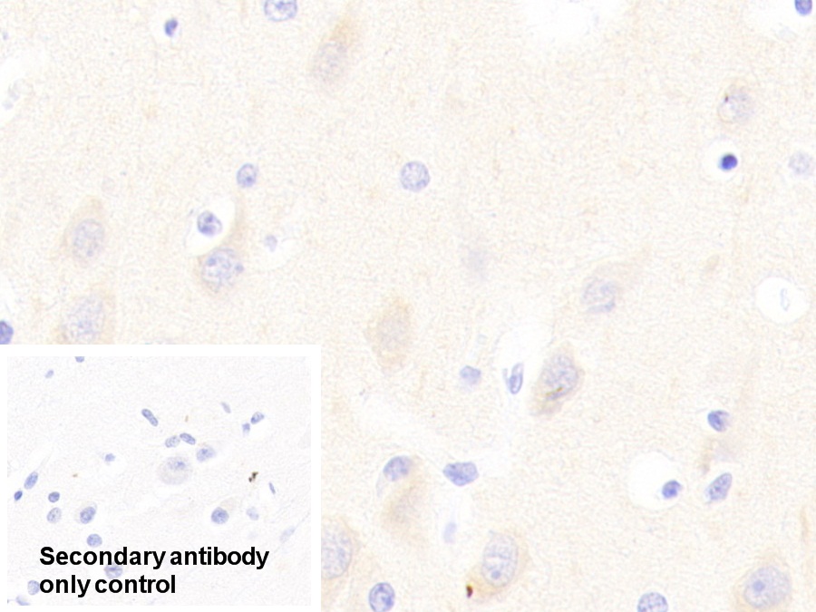 Polyclonal Antibody to Glycoprotein VI (GP6)