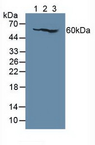 Polyclonal Antibody to Interleukin 7 Receptor (IL7R)