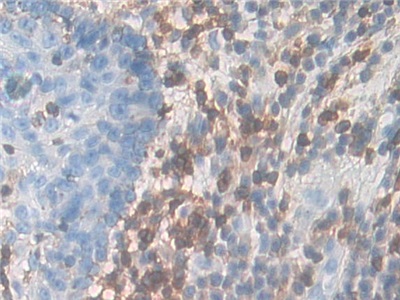 Polyclonal Antibody to Interleukin 7 Receptor (IL7R)