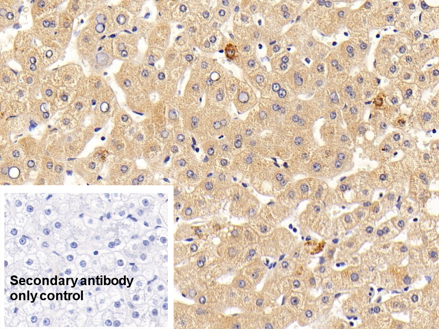 Polyclonal Antibody to Interleukin 7 Receptor (IL7R)