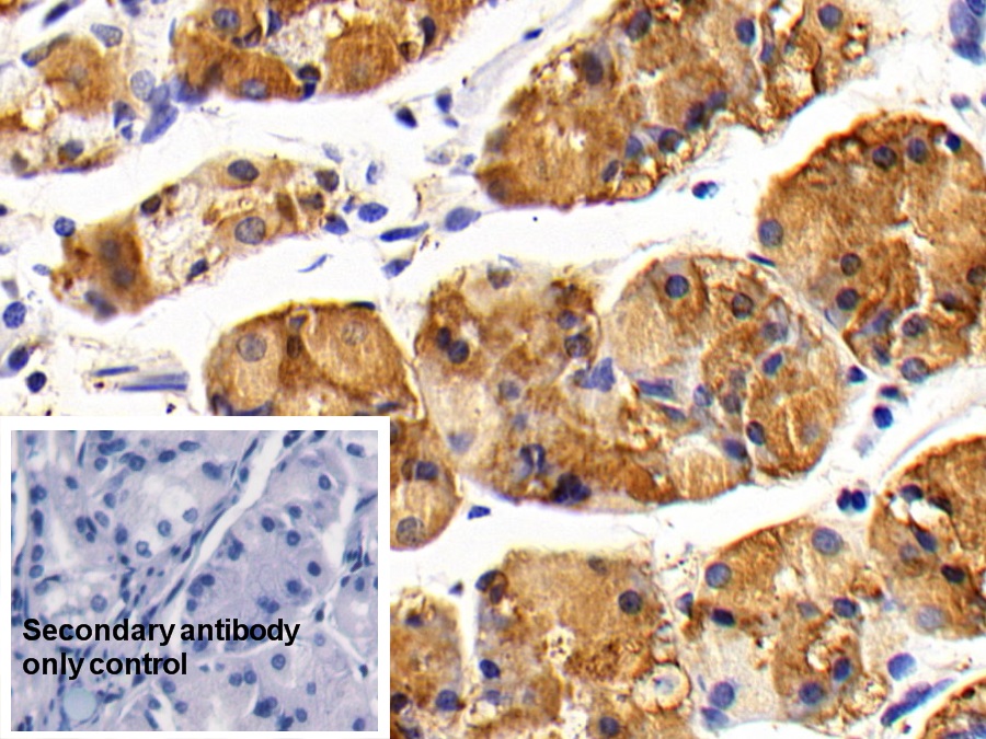 Polyclonal Antibody to Interleukin 7 Receptor (IL7R)