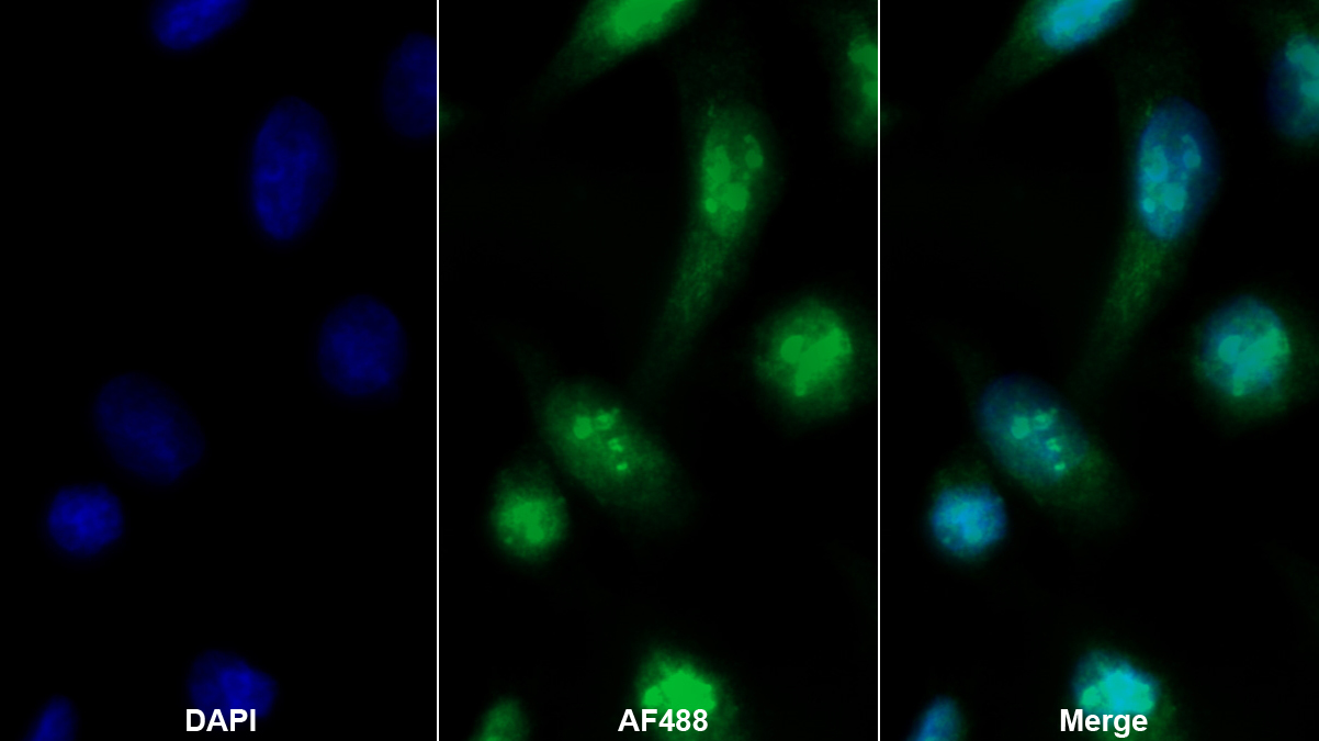 Polyclonal Antibody to Aggrecan (AGC)