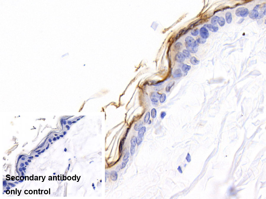 Polyclonal Antibody to Kallikrein 7 (KLK7)