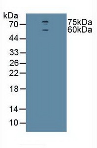 Polyclonal Antibody to Cholinergic Receptor, Nicotinic, Alpha 4 (CHRNa4)