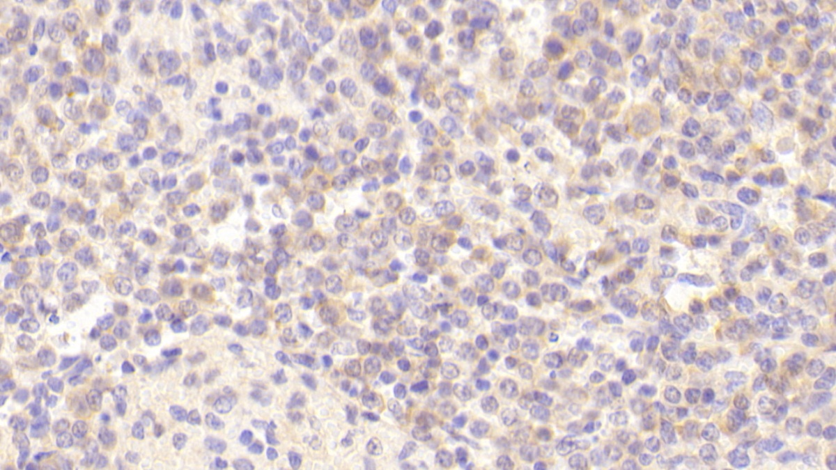 Polyclonal Antibody to Cholinergic Receptor, Nicotinic, Alpha 4 (CHRNa4)