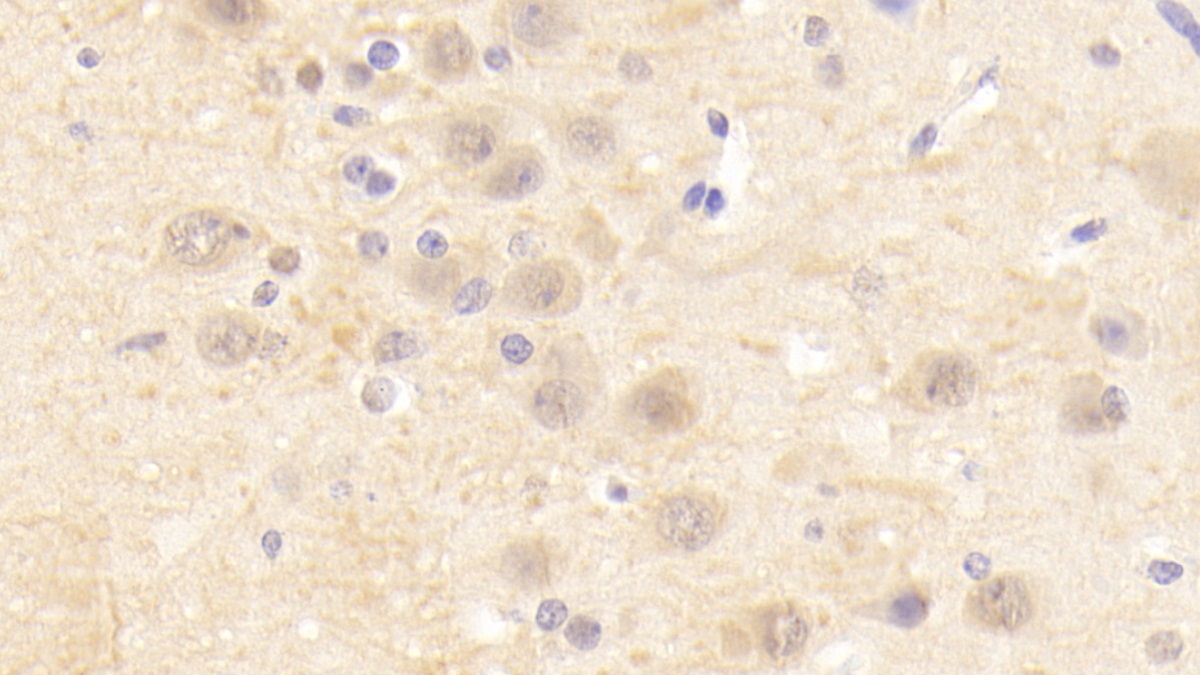 Polyclonal Antibody to Cholinergic Receptor, Nicotinic, Alpha 4 (CHRNa4)